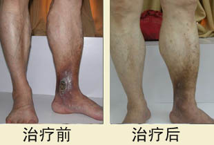 患者，张先生，男，41岁，安阳人