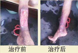 患者，王女士，女，32岁，长垣县人