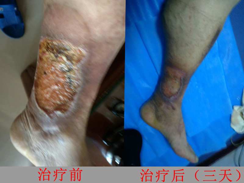 效果对比