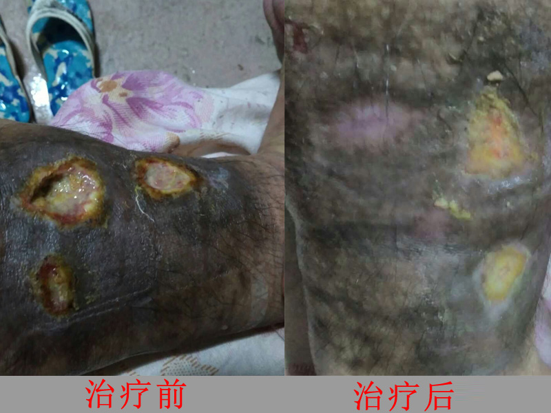 治疗前后对比