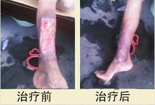 患者，魏先生，男，32岁，滑县人